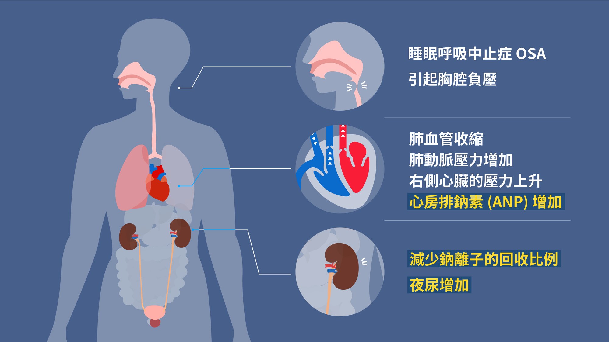 240925_OSA所引起的身體部位症狀_v1